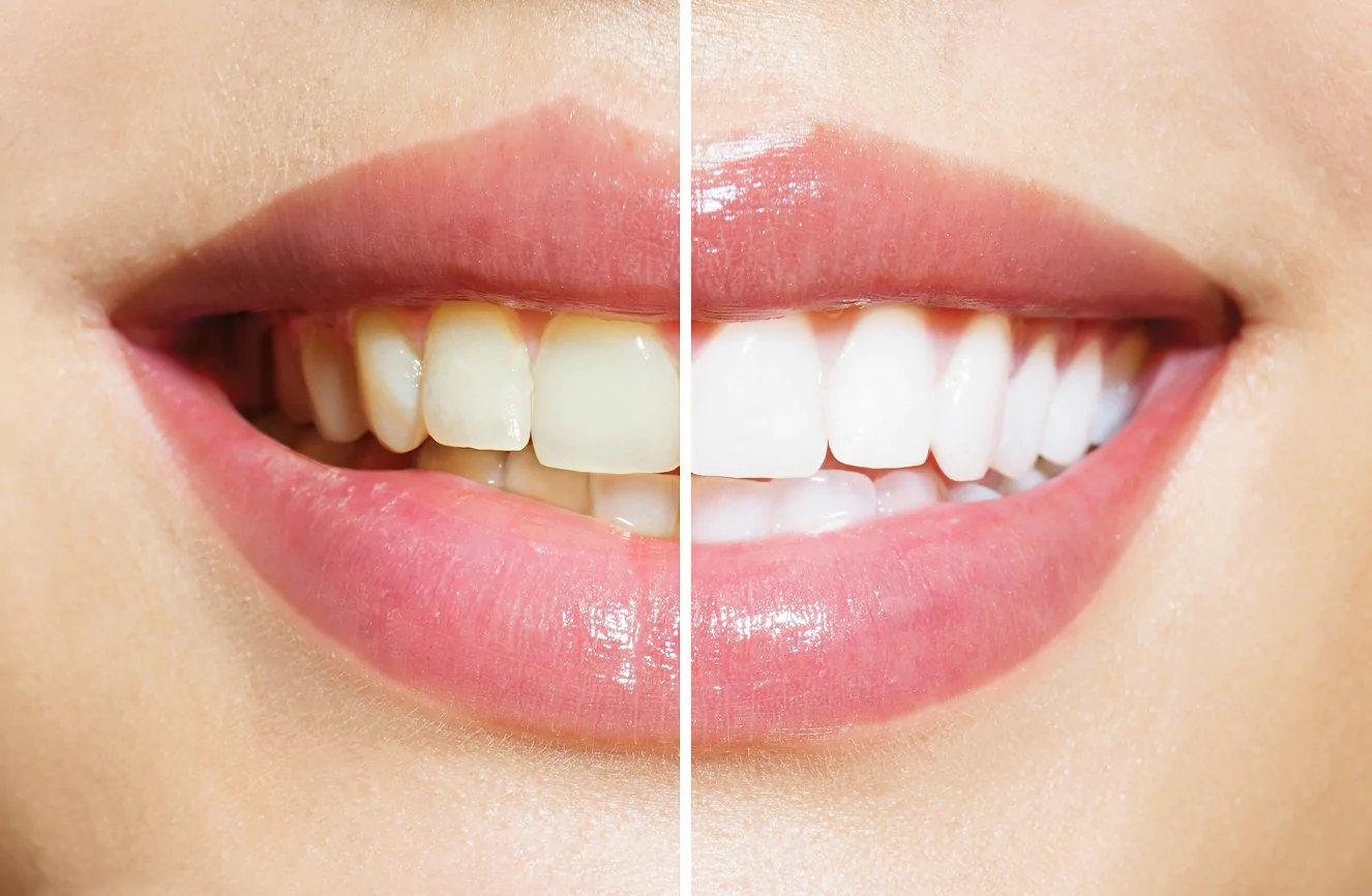 Cosmetic Dentistry Services